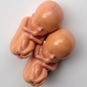 SLD zaczyna kampanię na rzecz aborcji na życzenie