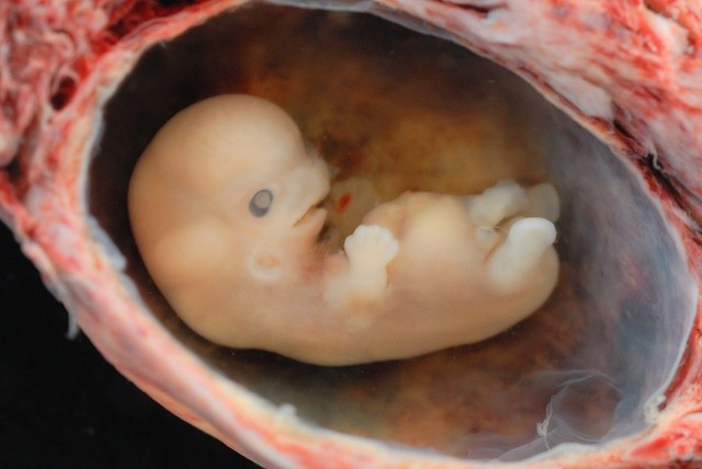 Francja: Ludzki embrion = materiał laboratoryjny?