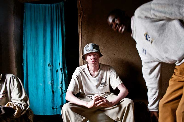18-letni albinos Vadasius Zanguli, gorliwy katolik, ze swoim czarnym tatą