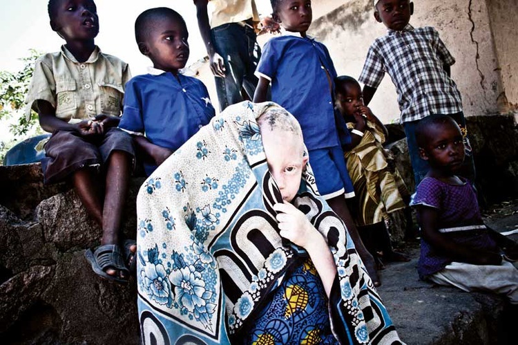 6-letnia Selivia Bukindo jest otoczona opieką swojej wioski