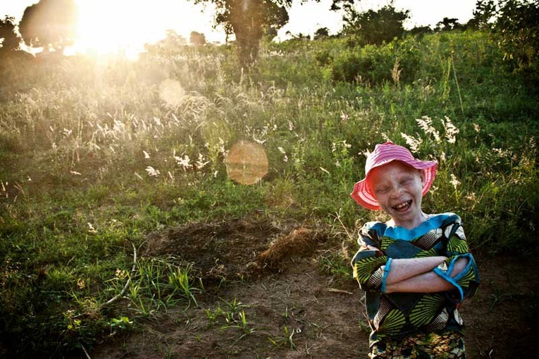 Słońce rani 8-letnią Generozę Apolinare ze wsi Bugombe. A jednak ona cieszy się życiem