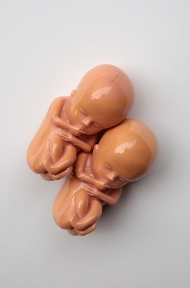 Niemcy: Przeciw selekcji embrionów 