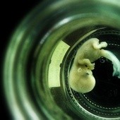 Embrionowi należy się ochrona