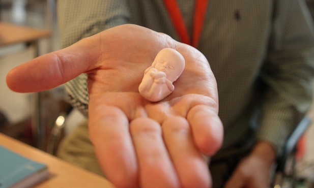 Pozew dla szpitala za zmuszanie do aborcji