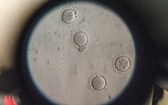 A od kobiety pobiera się w czasie punkcji wystymulowane hormonami nadliczbowe komórki jajowe (po prawej)