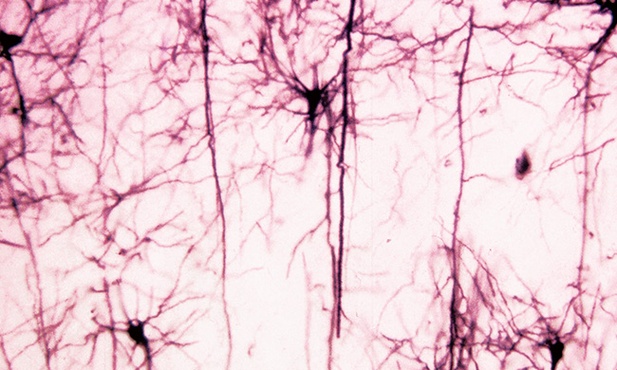 Ludzkie neurony