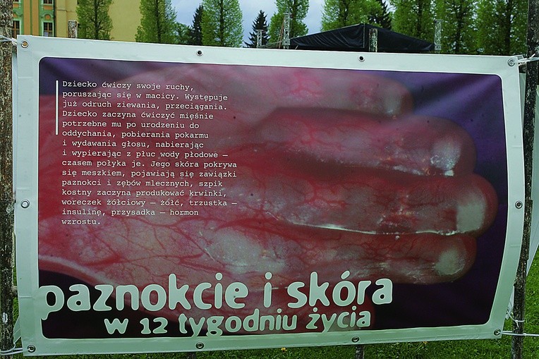  Nasi diecezjanie chętnie włączają się w inicjatywy promujące życie, np. wystawy, marsze i konferencje