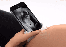 Ciążowe USG przy pomocy smartfona? Czemu nie!