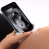 Ciążowe USG przy pomocy smartfona? Czemu nie!