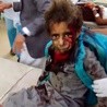 Atak na autobus szkolny pokazuje, że wojna w Jemenie nie rządzi się żadnymi zasadami