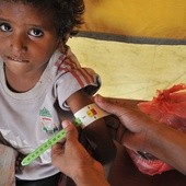 Jemen: Dzieci masowo umierają z głodu