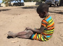 Największy problem Mozambiku: AIDS