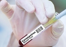 Gliwice. Narodowy Instytut Onkologii robi testy na obecność koronawirusa 