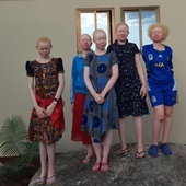 Trwa zbiórka pieniędzy na wyposażenie domu dla osób dotkniętych albinizmem w Tanzanii