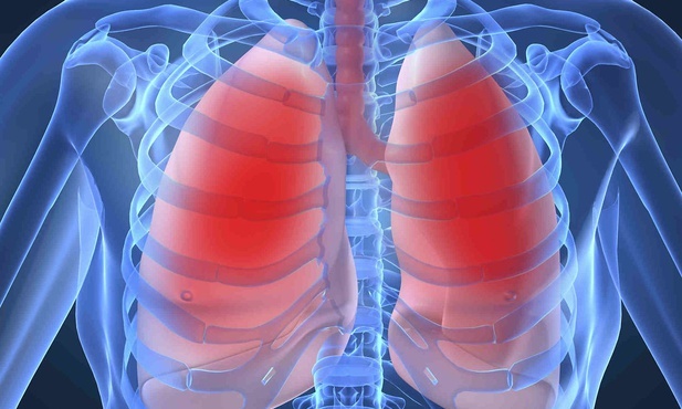 Rok po hospitalizacji z powodu COVID-19 co trzeci pacjent nadal ma zmiany w płucach