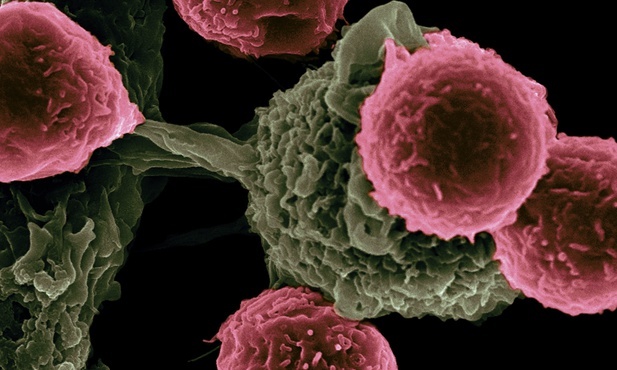 Naukowcy ogłaszają przełom w produkcji przeciwnowotworowych komórek