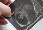 „Trudne ciąże. Jak Kościół pomaga kobietom?” - konferencja prasowa w Warszawie 