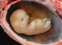 Co zrobić z zamrożonymi embrionami?