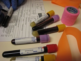 Miniaturowy układ analityczny zbada krew