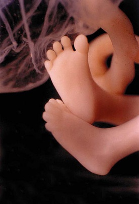 Uratować przed aborcją