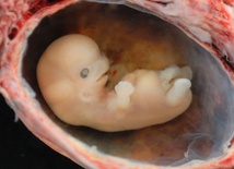 Ludzkie embriony do wyboru