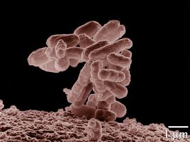 Trzeci przypadek E.coli w Polsce