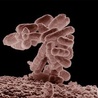 Trzeci przypadek E.coli w Polsce