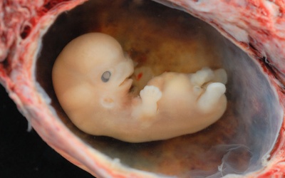 Francja: Ludzki embrion = materiał laboratoryjny?