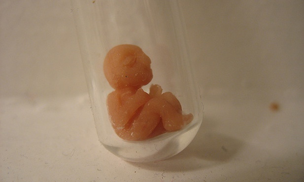 Apel o zakaz eugeniki przy "in vitro"