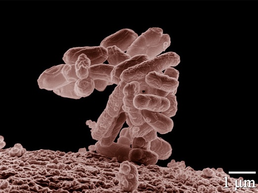 Nowy przypadek zakażenia E.coli w Polsce