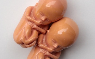 Niemcy: Przeciw selekcji embrionów 