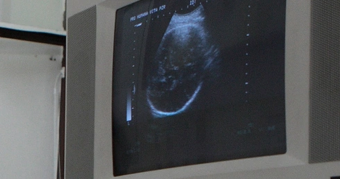 Przybywa zabitych po badaniach prenatalnych