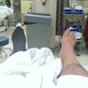 Pacjent po przeszczepie nóg za pół roku ma chodzić