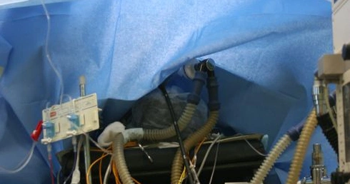 Doprecyzować definicję śmierci