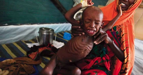 Somalijka i jej syn uciekli przed głodem do Kenii, do szpitala „Lekarzy bez Granic”