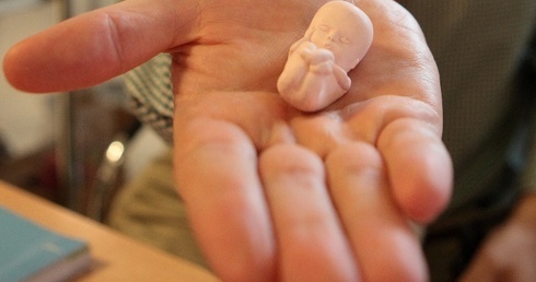Kanada: kobiety, które dokonały aborcji, znacznie częściej trafiają do szpitali z problemami psychicznymi