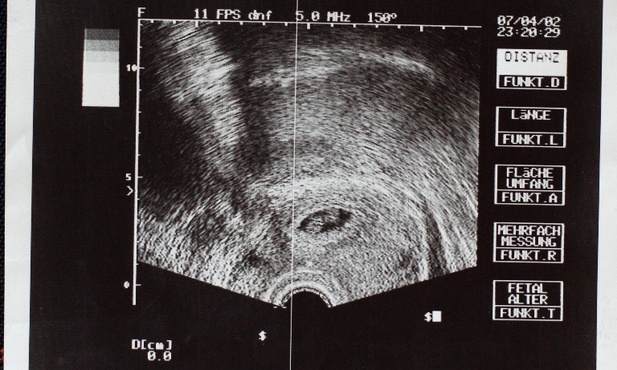 Nienarodzone to też niepełnoletnie