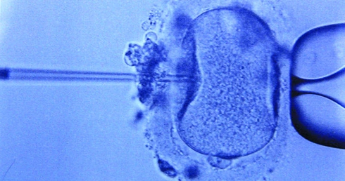 Czego nie widać in vitro?