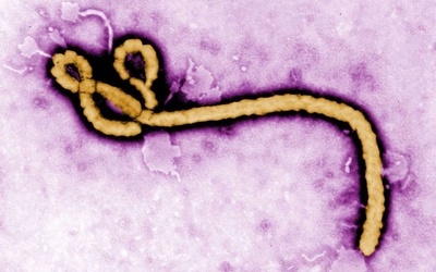 Wirus Ebola zaatakował w Ugandzie