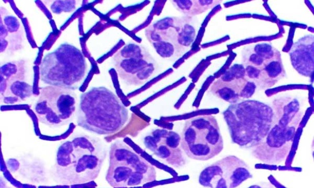 ZSRR planował wojnę biologiczną z USA