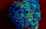 Nowe przeciwciało doskonale neutralizuje HIV
