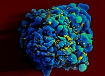 HIV u młodych mężczyzn szerzy się przez homoseks