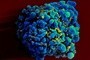 Nowe przeciwciało doskonale neutralizuje HIV