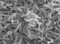 Wstępne wyniki badań pacjentki w Stargardzie: Nie jest to cholera