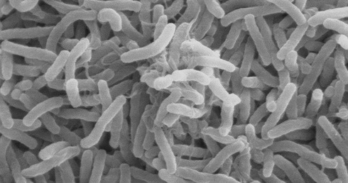 Wstępne wyniki badań pacjentki w Stargardzie: Nie jest to cholera