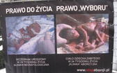 Wystawa antyaborcyjna "Wybierz życie" w Krakowie