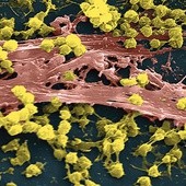 Te żółte kuleczki to komórki gronkowca złocistego odpornego na antybiotyki. Ta bakteria zabija więcej osób niż wirus HIV. Na zdjęciu z mikroskopu elektronowego jest powiększona ponad 2300 razy.