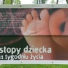 Zostań wolontariuszem i ocal abortowanych