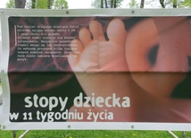 Zostań wolontariuszem i ocal abortowanych