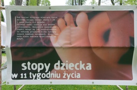 Zostań wolontariuszem i ocal abortowanych